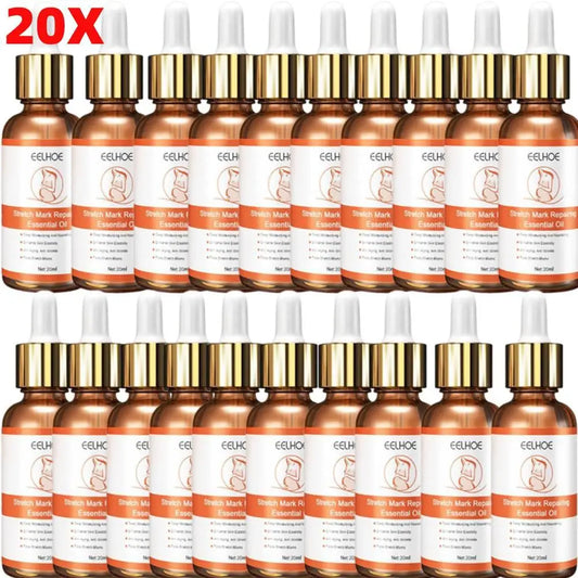 20Pcs Stretch Marks Removal Essential Oil 20ml Maternity Stretch Care Firming Body Old Cream Removal Mark Skin New Repair